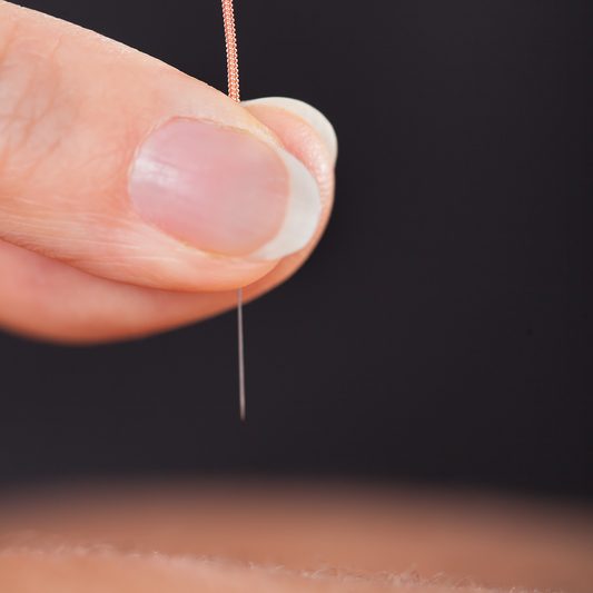 Acupuncture