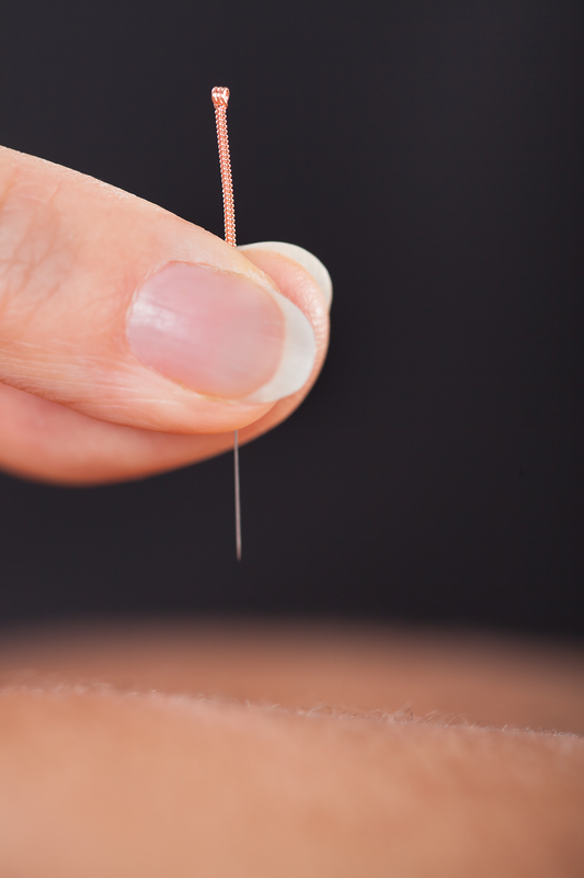 Acupuncture Treatment Acupuncture